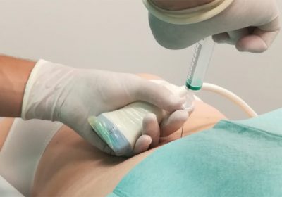 ozonoterapia-021120-01